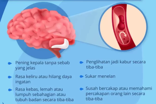 201019-Infographic_Tanda-tanda-strok-1024x1024